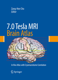 7.0 Tesla MRI Brain Atlas -  - E-Book