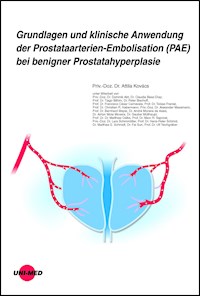 Grundlagen und klinische Anwendung der Prostataarterien-Embolisation (PAE) bei benigner Prostatahyperplasie - Attila Kovács - E-Book