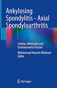 Ankylosing Spondylitis - Axial Spondyloarthritis -  - E-Book