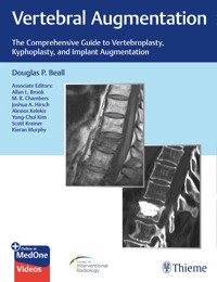 Vertebral Augmentation - Douglas P. Beall - E-Book