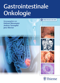 Gastrointestinale Onkologie - - E-Book