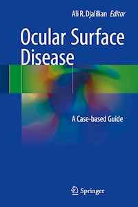 Ocular Surface Disease -  - E-Book