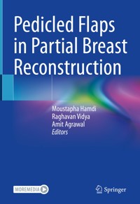 Pedicled Flaps in Partial Breast Reconstruction - - E-Book