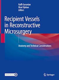 Recipient Vessels in Reconstructive Microsurgery -  - E-Book