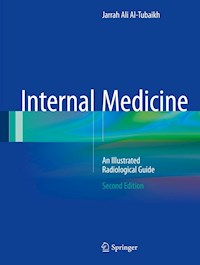 Internal Medicine - Jarrah Ali Al-Tubaikh - E-Book