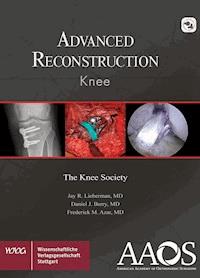 AAOS Advanced Reconstruction Knee - Jay R. Lieberman - E-Book