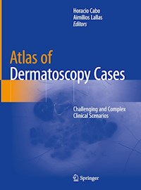 Atlas of Dermatoscopy Cases - - E-Book