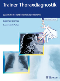 Trainer Thoraxdiagnostik - Johannes Kirchner - E-Book