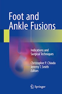 Foot and Ankle Fusions -  - E-Book