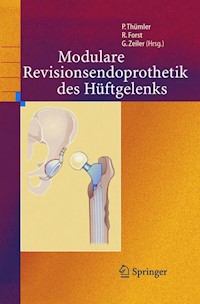 Modulare Revisionsendoprothetik des Hüftgelenks -  - E-Book