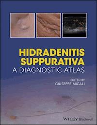 Hidradenitis Suppurativa -  - E-Book