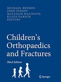 Children’s Orthopaedics and Fractures -  - E-Book