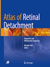 Atlas of Retinal Detachment - - E-Book