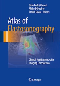 Atlas of Elastosonography - - E-Book