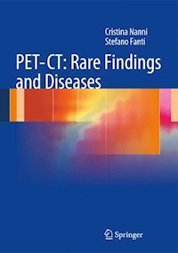 PET-CT: Rare Findings and Diseases - Cristina Nanni - E-Book