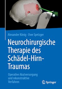 Neurochirurgische Therapie des Schädel-Hirn-Traumas - Alexander König - E-Book