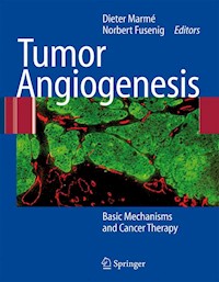 Tumor Angiogenesis -  - E-Book