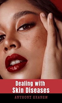 Dealing with Skin Diseases - Anthony Ekanem - E-Book