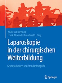 Laparoskopie in der chirurgischen Weiterbildung -  - E-Book