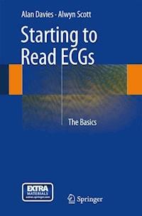 Starting to Read ECGs - Alan Davies - E-Book