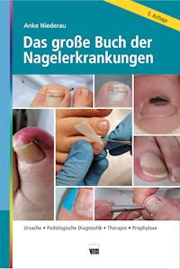 Das große Buch der Nagelerkrankungen - Anke Niederau - E-Book