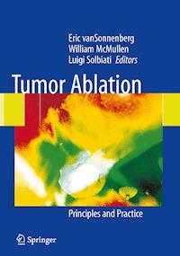 Tumor Ablation -  - E-Book