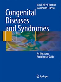 Congenital Diseases and Syndromes - Jarrah Ali Al-Tubaikh - E-Book