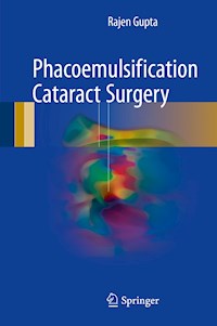 Phacoemulsification Cataract Surgery - Rajen Gupta - E-Book