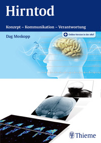 Hirntod - Dag Moskopp - E-Book