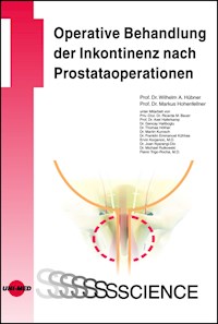 Operative Behandlung der Inkontinenz nach Prostataoperationen - Wilhelm A. Hübner - E-Book