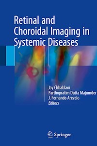 Retinal and Choroidal Imaging in Systemic Diseases -  - E-Book