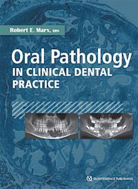 Oral Pathology in Clinical Dental Practice - Robert E. Marx - E-Book