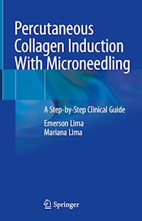 Percutaneous Collagen Induction With Microneedling - Emerson Lima - E-Book