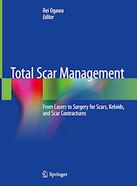 Total Scar Management -  - E-Book