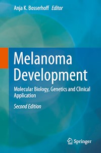 Melanoma Development -  - E-Book