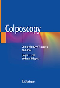 Colposcopy - Ralph J. Lellé - E-Book