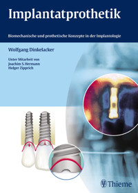 Implantatprothetik - Wolfgang Dinkelacker - E-Book