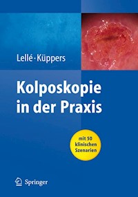 Kolposkopie in der Praxis - Ralph J. Lellé - E-Book