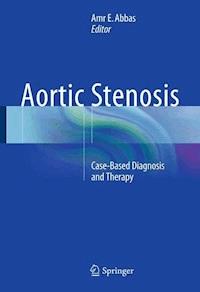 Aortic Stenosis -  - E-Book