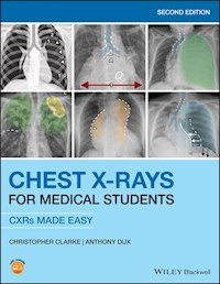 Chest X-Rays for Medical Students - Christopher Clarke - E-Book