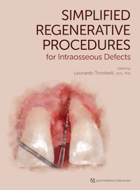 Simplified Regenerative Procedures for Intraosseous Defects - Leonardo Trombelli - E-Book