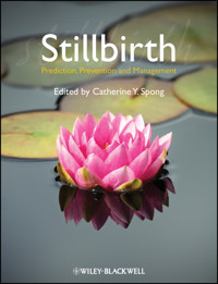 Stillbirth -  - E-Book