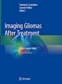 Imaging Gliomas After Treatment - - E-Book