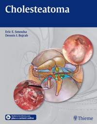 Cholesteatoma - Eric E. Smouha - E-Book