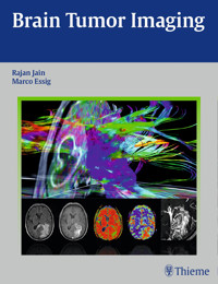 Brain Tumor Imaging - Rajan Jain - E-Book