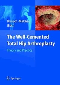 The Well-Cemented Total Hip Arthroplasty -  - E-Book
