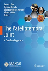 The Patellofemoral Joint -  - E-Book