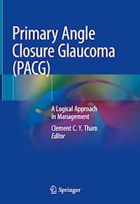 Primary Angle Closure Glaucoma (PACG) -  - E-Book