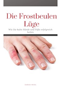 Die Frostbeulen Lüge - Sarah Mika - E-Book