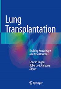 Lung Transplantation -  - E-Book